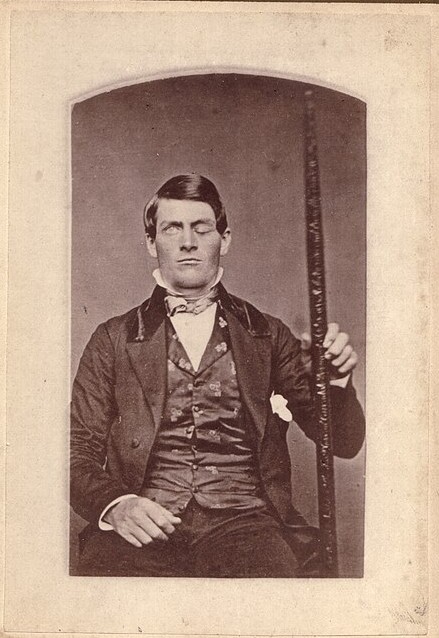 Phineas Gage posant avec sa fameuse barre