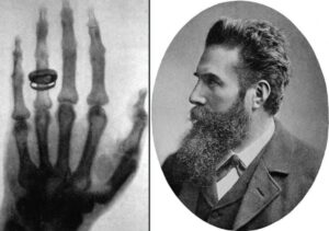 Wilhelm Rontgen découvreur des rayons X
