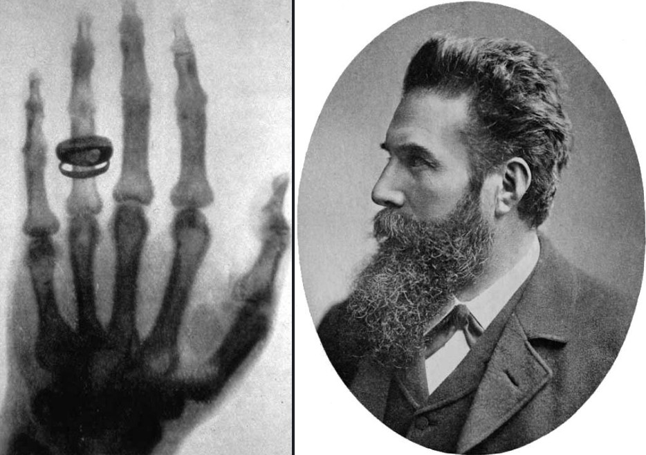 Wilhelm Rontgen découvreur des rayons X
